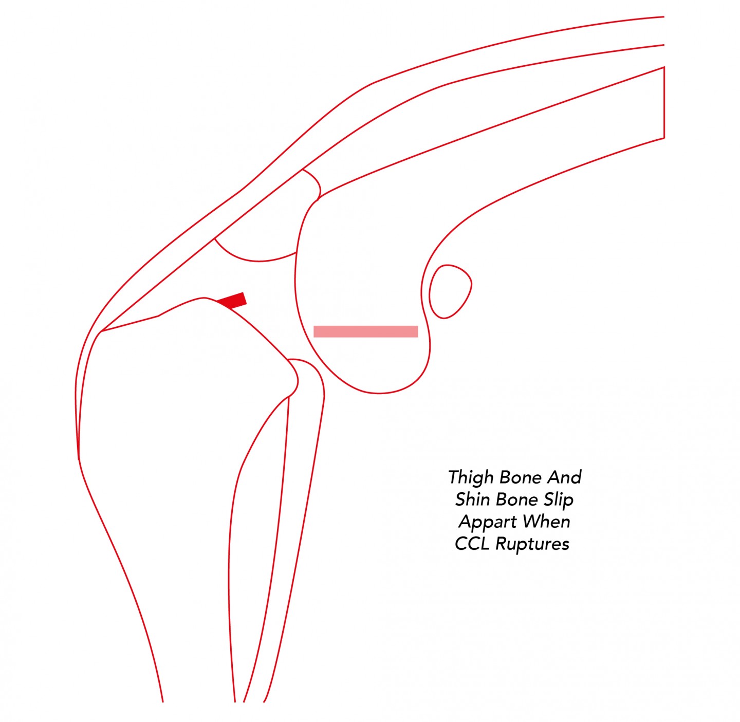 Cruciate Ligament Rupture – Dog Knee Surgery Cardiff | Cardiff Canine ...